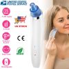 Electronic Blackhead Remover with Vacuum, Facial Acne, and Pores