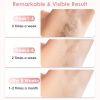 IPL Laser Hair Removal For Woman/Man, Painless, 999999 Flashes
